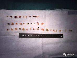 中国产纳米镜视频,中国创新科技之光，揭秘微观世界的奥秘